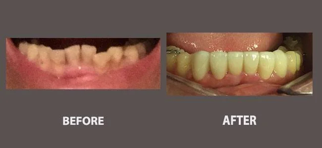 Smile gallery case 21: before and after treatment